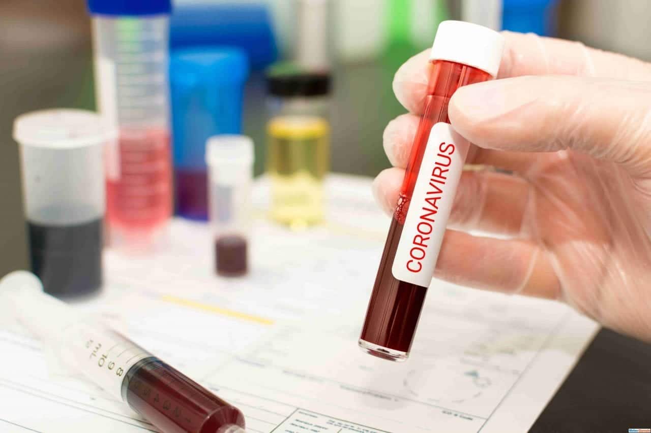 Coronavirus, il Comunicato Stampa di oggi 12 Giugno 2020