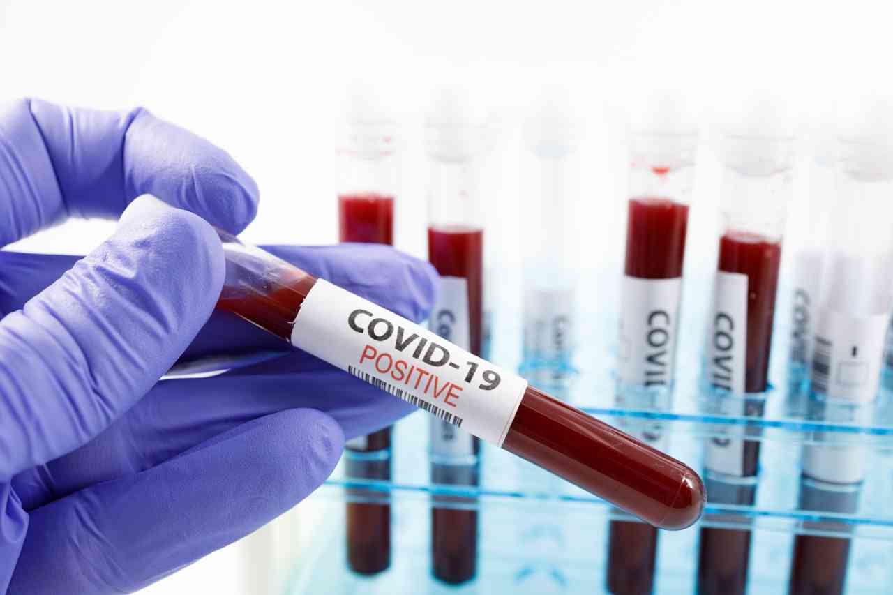 Coronavirus: i debolmente positivi saranno conteggiati a parte