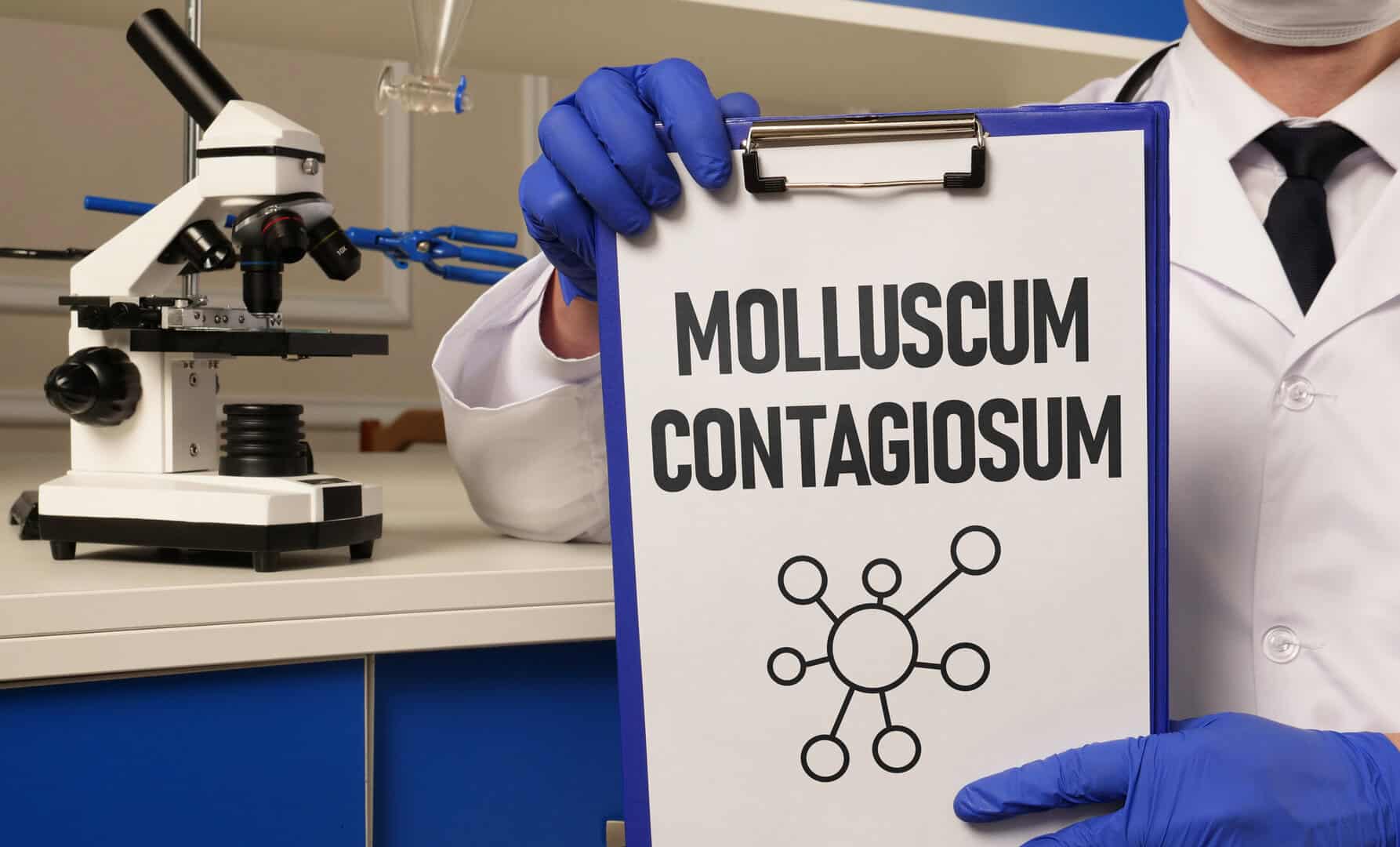 Mollusco contagioso: caratteristiche, diagnosi e cura di un virus della pelle