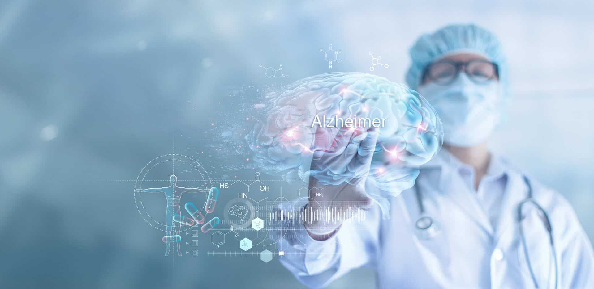 Oltre i bersagli tradizionali: nuove ricerche sulle proteine rivoluzionano i trattamenti dell’Alzheimer