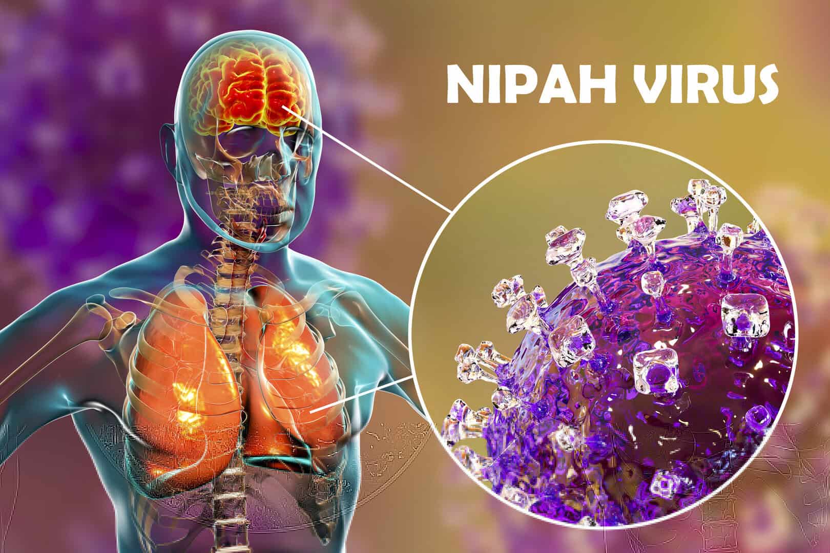 virus nipah sintomi