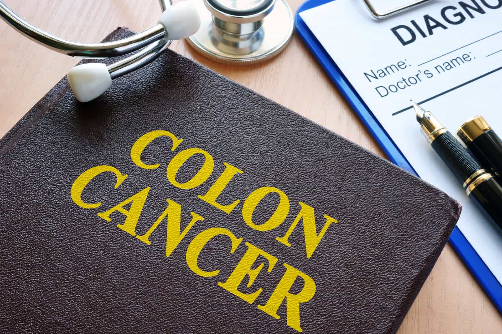cancro colon test prevenzione