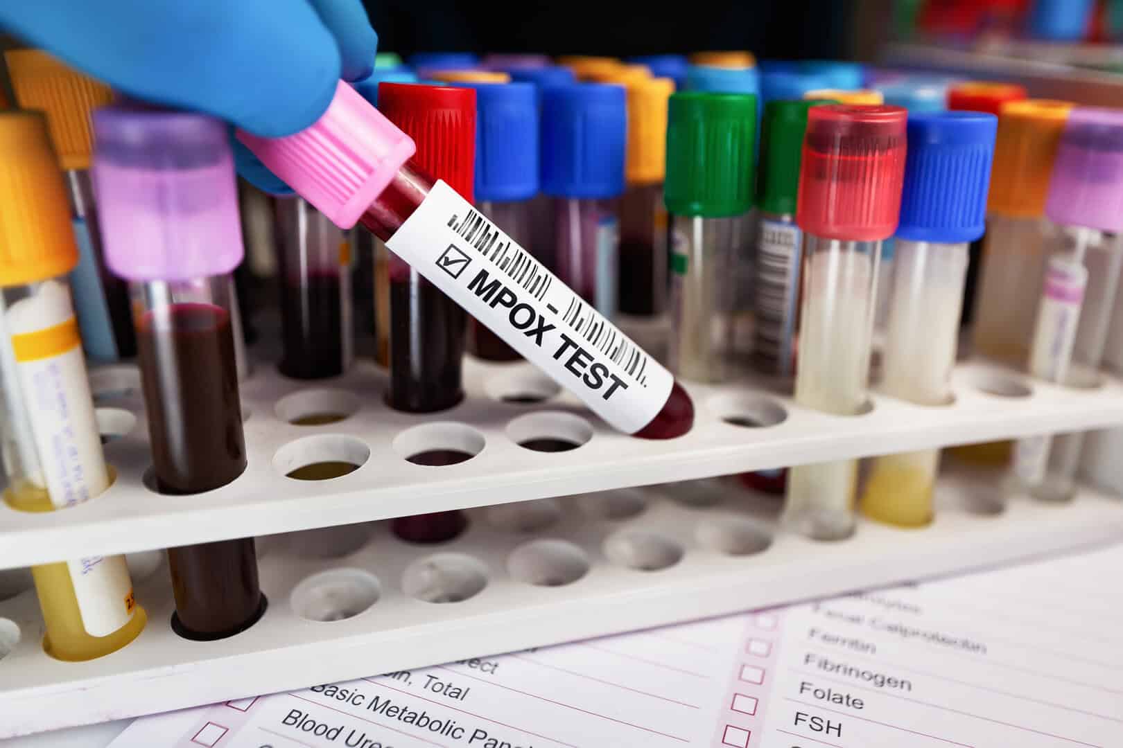 mpox vaiolo delle scimmie
