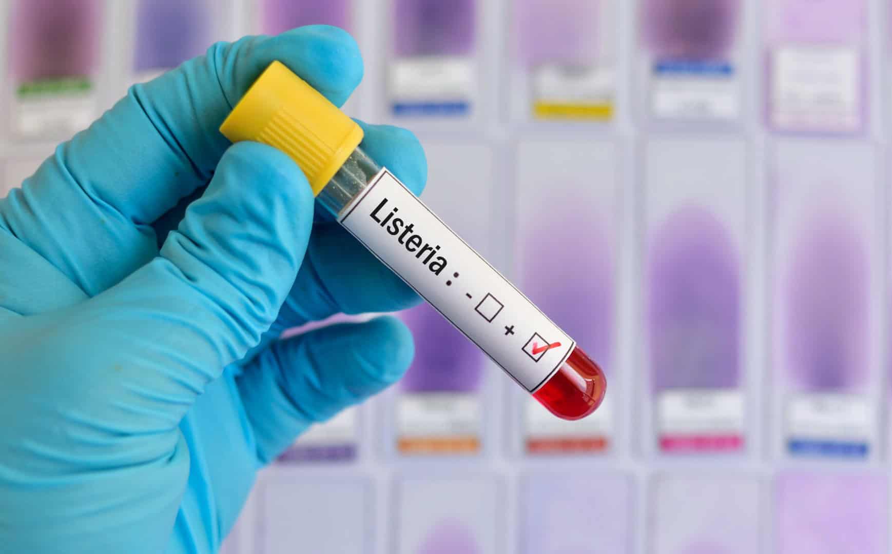 Prodotti richiamati in Italia per possibile contaminazione da Listeria